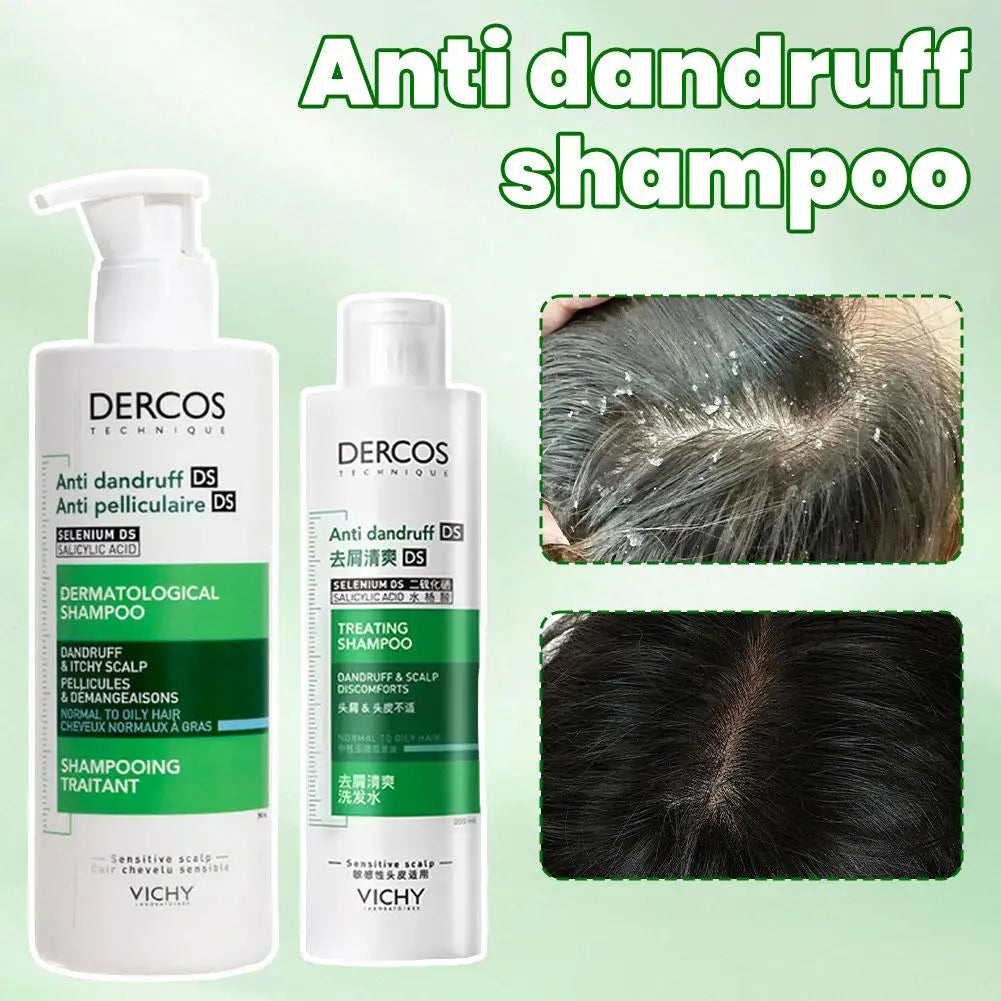 Control Oil Shampoo Dandruff Clearing And Soothing Silky Supple Improve Scalp Environment Restore Damaged Hair Care Product