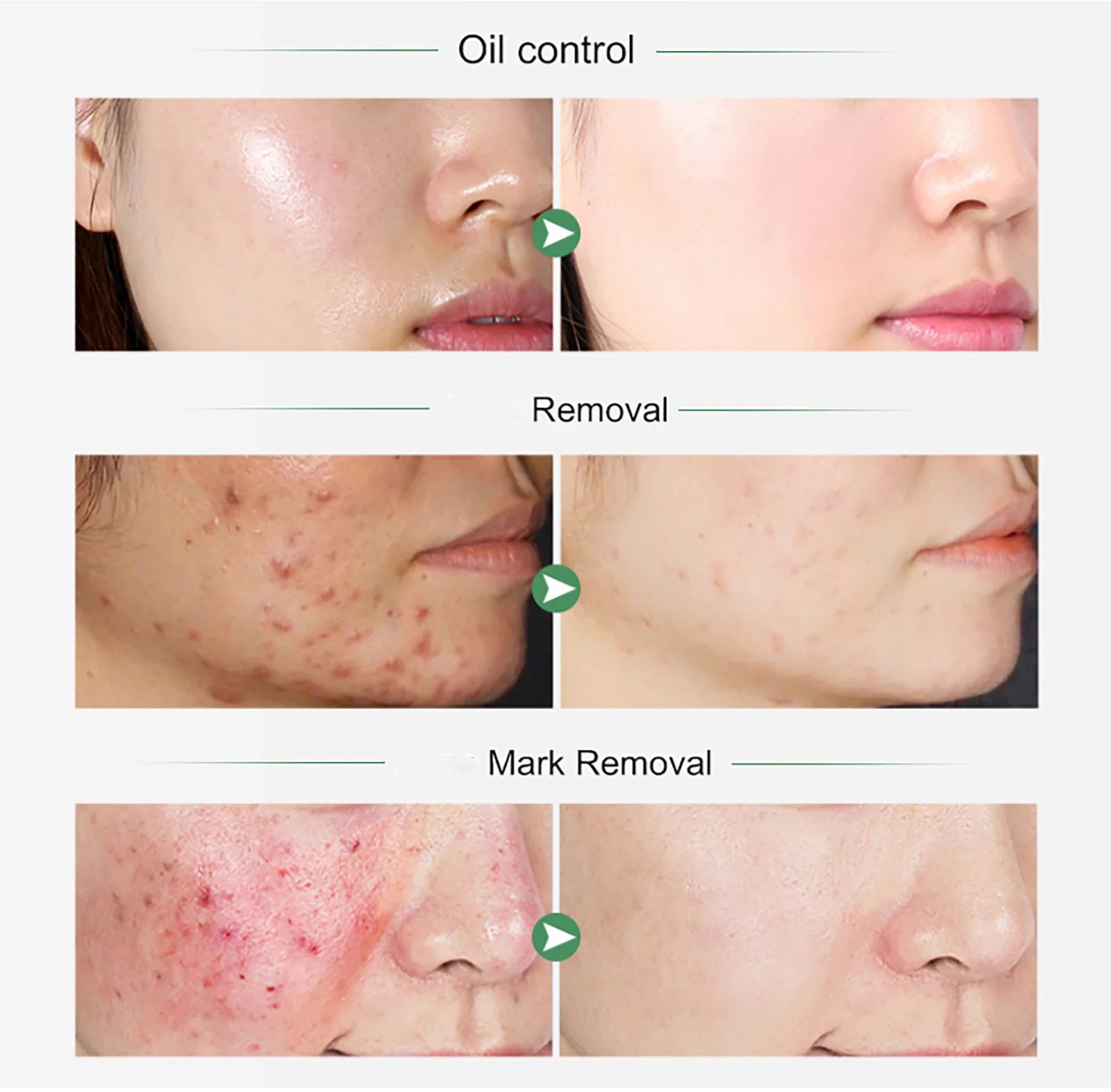 AILKE Organic Turmeric Whitening Skin Care Vitamin C