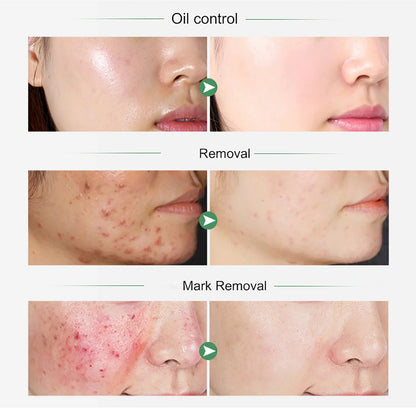 AILKE Organic Turmeric Whitening Skin Care Vitamin C