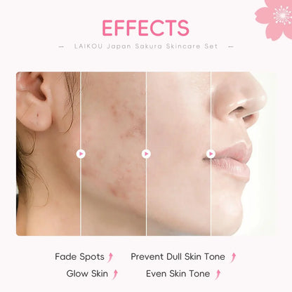 Japan Sakura Skincare Set 4pcs Hydrating Tightening Serum