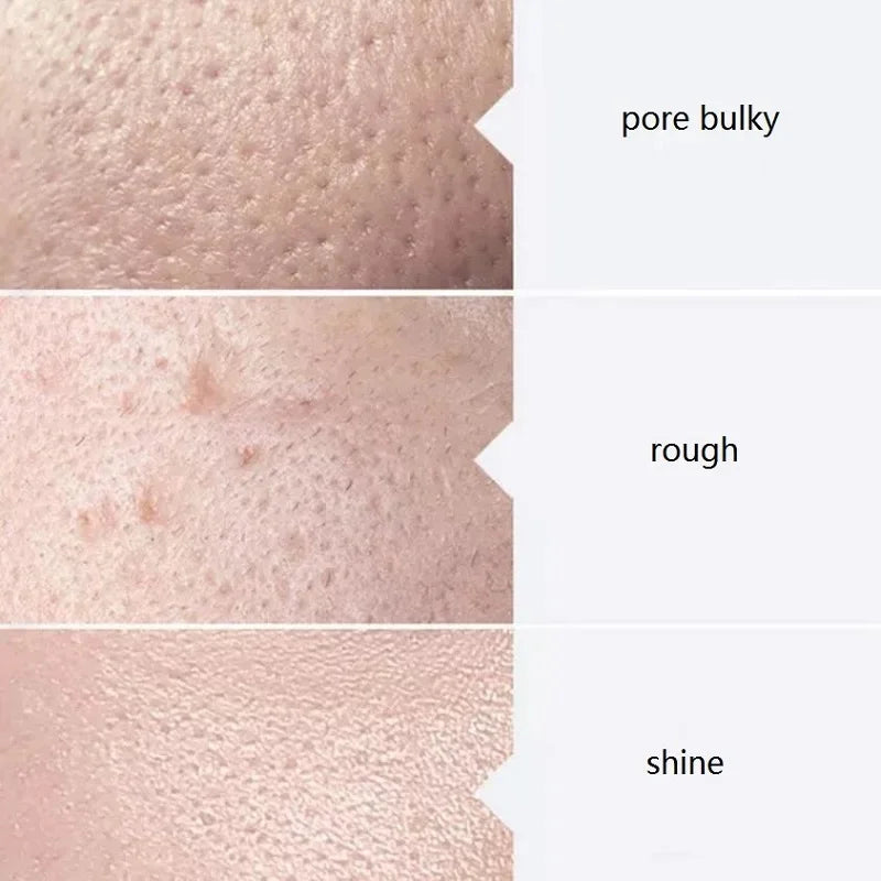 Facial Skincare Face Serum AS1 SA2 AO3 Aqua Peel