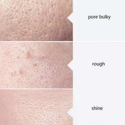 Facial Skincare Face Serum AS1 SA2 AO3 Aqua Peel