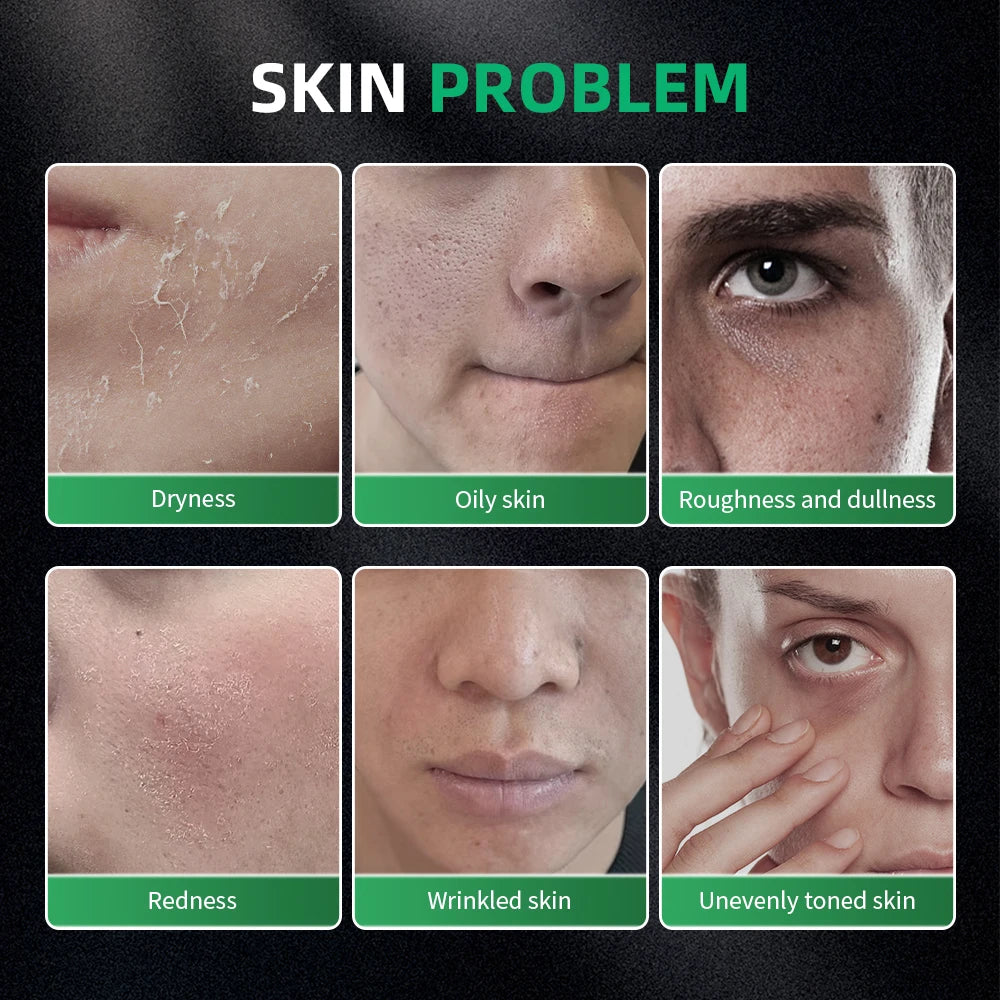 Skin Care for Men Kit Controls Oil Moisturizes Exfoliating Firming Use For Oily Dry Rough Dull Red Skin Gift for men